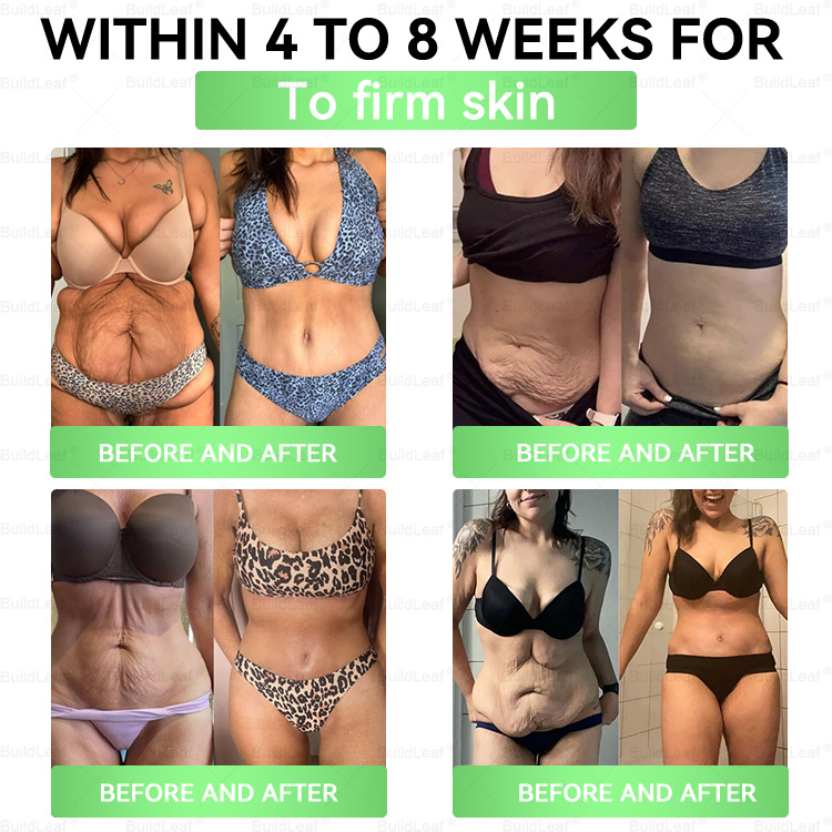 🎁 Only 5 boxes left! Extra 30% off 𝐵uil𝗱𝐿ea𝐟® 𝑮𝐋𝑃-1 8-in-1 Oral Liquid! Help you shape your perfect body and stay healthy. Miss it now or you'll have to wait until next year.