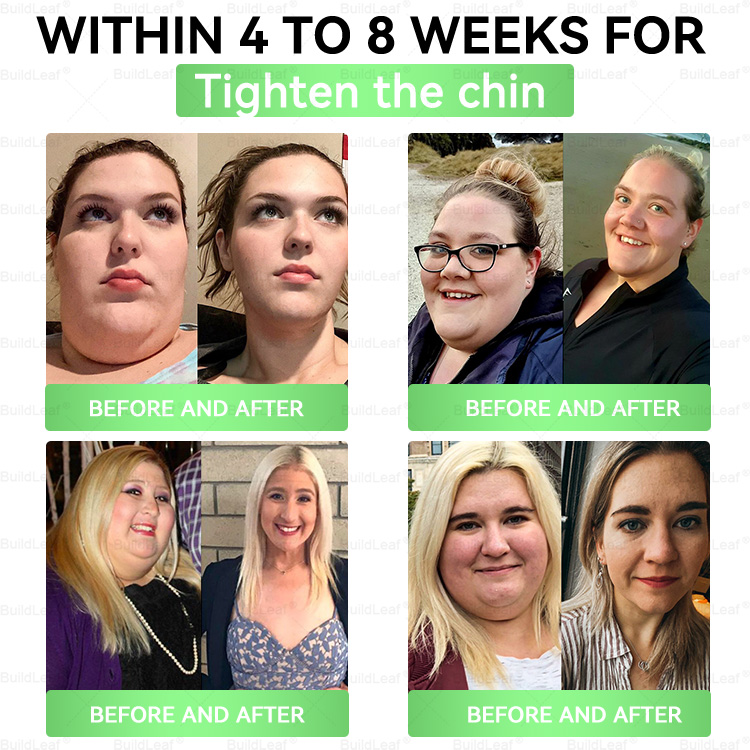 🎁 Only 5 boxes left! Extra 30% off 𝐵uil𝗱𝐿ea𝐟® 𝑮𝐋𝑃-1 8-in-1 Oral Liquid! Help you shape your perfect body and stay healthy. Miss it now or you'll have to wait until next year.